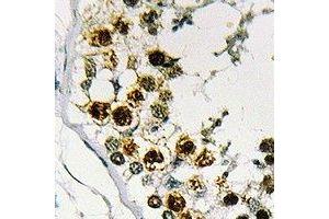Immunohistochemical analysis of STAG3 staining in human testis formalin fixed paraffin embedded tissue section. (STAG3 antibody  (C-Term))