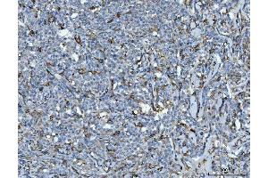 IHC analysis of CD14 using anti-CD14 antibody (ABIN7600531). (CD14 antibody  (AA 20-259))