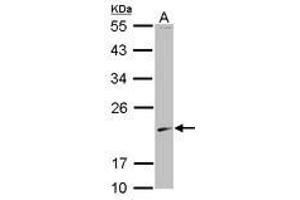 Image no. 1 for anti-S-Phase Kinase-Associated Protein 1 (SKP1) (AA 1-110) antibody (ABIN1500945) (SKP1 antibody  (AA 1-110))