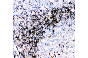 Anti- CD79A picoband antibody, IHC(P) IHC(P): Human Tonsil Tissue (CD79a antibody  (AA 121-226))
