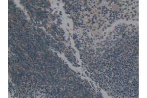 Detection of Hsp60 in Mouse Spleen Tissue using Polyclonal Antibody to Heat Shock Protein 60 (Hsp60) (HSPD1 antibody  (AA 316-573))