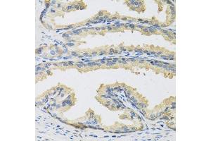 Immunohistochemistry of paraffin-embedded human prostate using CST3 antibody. (CST3 antibody  (AA 27-146))