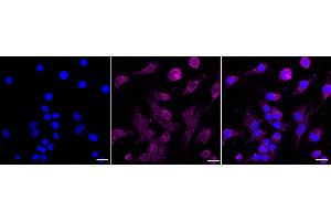 anti-Receptor Tyrosine Kinase-Like Orphan Receptor 2 (ROR2) antibody