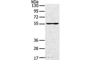 Western blot analysis of PC3 cell, using UBP1 Polyclonal Antibody at dilution of 1:200 (UBP1 antibody)