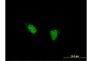 Immunofluorescence of monoclonal antibody to TSHZ1 on HeLa cell. (TSHZ1 antibody  (AA 619-717))