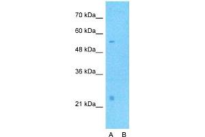 Host:  Rabbit  Target Name:  CD40LG  Sample Type:  Human Fetal Muscle  Lane A:  Primary Antibody  Lane B:  Primary Antibody + Blocking Peptide  Primary Antibody Concentration:  1ug/ml  Peptide Concentration:  5ug/ml  Lysate Quantity:  25ug/lane/lane  Gel Concentration:  0. (CD40 Ligand antibody  (Middle Region))