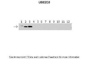 Western Blotting (WB) image for anti-Ubiquitin-Conjugating Enzyme E2D 3 (UBE2D3) (N-Term) antibody (ABIN2775674)