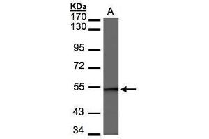 WB Image Sample(30 μg of whole cell lysate) A:Raji, 7. (SMARCE1 antibody  (C-Term))