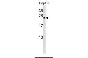 Western blot analysis of Gamma-crystallin B Antibody  in HepG2 cell line lysates (35ug/lane). (CRYGB antibody  (Middle Region))