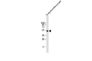 Anti-HSV tag Antibody at 1:2000 dilution + 12 tag recombinant protein lysate Lysates/proteins at 20 μg per lane. (HSV Tag antibody)
