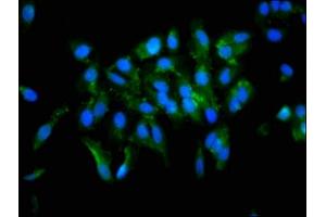 Immunofluorescence staining of Hela cells with ABIN7166409 at 1:133, counter-stained with DAPI. (Transglutaminase 2 antibody  (AA 4-544))