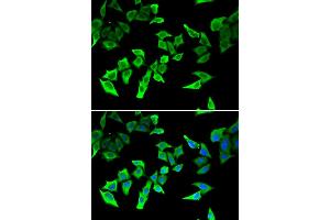 Immunofluorescence analysis of U2OS cells using MLH1 antibody (ABIN5970084). (MLH1 antibody)