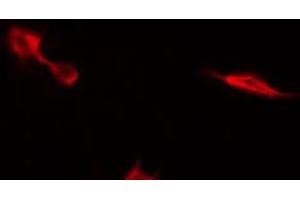 ABIN6269121 staining NIH-3T3 by IF/ICC. (c-MET antibody  (C-Term))