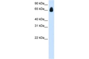 Western Blotting (WB) image for anti-Tripartite Motif Containing 32 (TRIM32) antibody (ABIN2461828) (TRIM32 antibody)