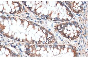 Immunohistochemistry of paraffin-embedded Human colon using Aquaporin 4 Polyclonal Antibody at dilution of 1:100 (40x lens). (Aquaporin 4 antibody)