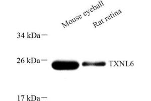 Western blot analysis of TXNL6 (ABIN7074917) at dilution of 1: 500 (NXNL1 antibody)