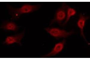 ABIN6277805 staining 293 by IF/ICC. (NCR1 antibody  (Internal Region))