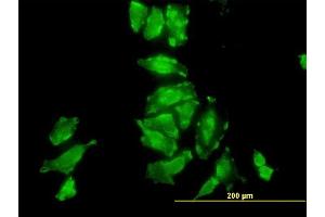 Immunofluorescence of monoclonal antibody to PSMD10 on HeLa cell. (PSMD10 antibody  (AA 127-226))