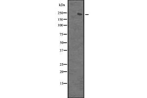 Western blot analysis of XRN1 expression in Hela cell lysate,The lane on the left is treated with the antigen-specific peptide. (XRN1 antibody  (N-Term))