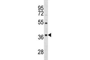 ORAI3 antibody western blot analysis in HepG2 lysate. (ORAI3 antibody  (AA 1-30))