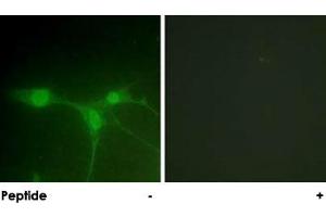 Immunofluorescence analysis of NIH/3T3 cells, using PTK6 polyclonal antibody . (PTK6 antibody)
