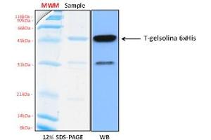 Western Blotting (WB) image for Gelsolin (GSN) (AA 404-782), (C-Term) protein (His tag) (ABIN5675806) (Gelsolin Protein (GSN) (AA 404-782, C-Term) (His tag))