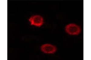 Immunofluorescence (fixed cells) (IF/ICC) image for anti-Protein tyrosine Phosphatase, Receptor Type, C (PTPRC) (pSer1007) antibody (ABIN6254922)
