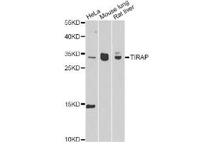 Western blot analysis of extracts of various cell lines, using TIRAP antibody (ABIN6292427) at 1:1000 dilution. (TIRAP antibody)