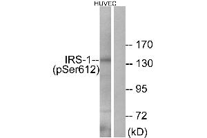 Western blot analysis of extracts from HUVEC cells, treated with insulin (0. (IRS1 antibody  (pSer612))