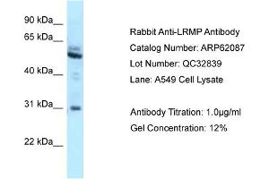 Western Blotting (WB) image for anti-Lymphoid-Restricted Membrane Protein (LRMP) (C-Term) antibody (ABIN2789013) (LRMP antibody  (C-Term))
