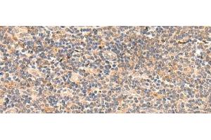 Immunohistochemistry of paraffin-embedded Human tonsil tissue using TEAD3 Polyclonal Antibody at dilution of 1:50(x200) (TEAD3 antibody)