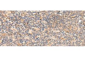 Immunohistochemistry of paraffin-embedded Human tonsil tissue using TEAD3 Polyclonal Antibody at dilution of 1:50(x200)