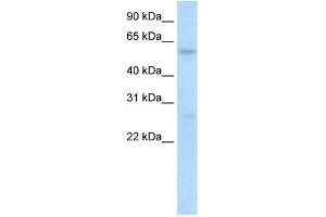 WB Suggested Anti-HIC2 Antibody Titration:  0. (HIC2 antibody  (N-Term))