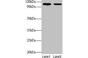 Western blot All lanes: EXTL3 antibody at 2 μg/mL Lane 1: EC109 whole cell lysate Lane 2: 293T whole cell lysate Secondary Goat polyclonal to rabbit IgG at 1/15000 dilution Predicted bane side: 105 kDa Observed band side: 105 kDa
