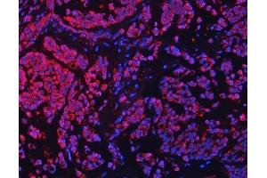 IF analysis of TFEB using anti-TFEB antibody (ABIN7600648). (TFEB antibody  (AA 214-326))