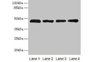 Western blot All lanes: ZDHHC23 antibody at 8 μg/mL Lane 1: 293T whole cell lysate Lane 2: Mouse brain tissue Lane 3: A549 whole cell lysate Lane 4: Human placenta tissue Secondary Goat polyclonal to rabbit IgG at 1/10000 dilution Predicted band size: 46 kDa Observed band size: 46 kDa (ZDHHC23 antibody  (AA 187-302))
