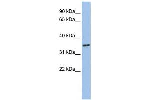 Western Blotting (WB) image for anti-PHD Finger Protein 13 (PHF13) antibody (ABIN2459472) (PHF13 antibody)