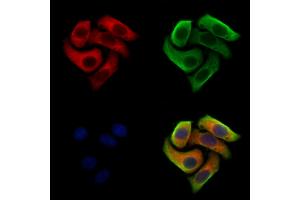 ABIN7094421 and ABIN7098468 staining Hela cells by IF/ICC. (Clathrin antibody  (C-Term))