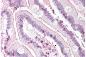 Human Small Intestine (formalin-fixed, paraffin-embedded) stained with RTEL1 antibody ABIN334244 at 5 ug/ml followed by biotinylated goat anti-rabbit IgG secondary antibody ABIN481713, alkaline phosphatase-streptavidin and chromogen. (RTEL1 antibody  (N-Term))