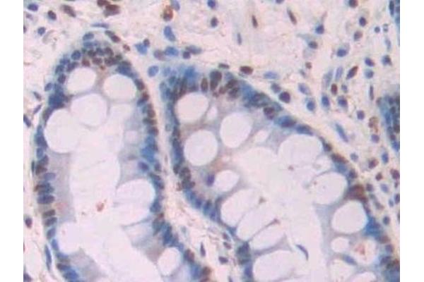 Abeta 1-42 antibody