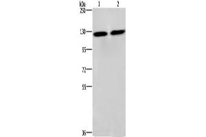 Gel: 6 % SDS-PAGE, Lysate: 40 μg, Lane 1-2: PC3 cells, lovo cells, Primary antibody: ABIN7128916(CEP97 Antibody) at dilution 1/750, Secondary antibody: Goat anti rabbit IgG at 1/8000 dilution, Exposure time: 3 seconds