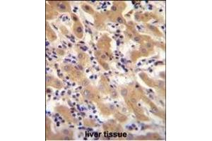 F11 Antibody (Center) (ABIN655515 and ABIN2845030) immunohistochemistry analysis in formalin fixed and paraffin embedded human liver tissue followed by peroxidase conjugation of the secondary antibody and DAB staining. (Factor XI antibody  (AA 281-307))