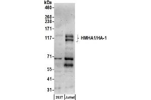 anti-Histocompatibility (Minor) HA-1 (HMHA1) (AA 100-150) antibody