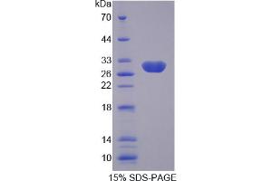 Image no. 1 for Sodium Channel, Nonvoltage-Gated 1, gamma (SCNN1G) (AA 1-182) protein (His tag) (ABIN4989792)