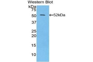 Detection of Recombinant IFNb, Human using Polyclonal Antibody to Interferon Beta (IFNb) (IFNB1 antibody  (AA 22-187))