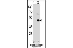Western blot analysis of MAGEA9 using rabbit polyclonal MAGEA9 Antibody (C185) using 293 cell lysates (2 ug/lane) either nontransfected (Lane 1) or transiently transfected (Lane 2) with the MAGEA9 gene. (MAGEA9 antibody  (AA 171-198))