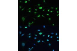 Immunofluorescence analysis of U-2 OS cells using MDC1 antibody (ABIN6131721, ABIN6143660, ABIN6143662 and ABIN6224387) at dilution of 1:100. (MDC1 antibody  (AA 1-350))
