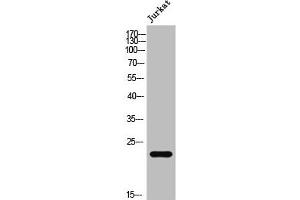 Western Blot analysis of Jurkat cells using AKAP 14 Polyclonal Antibody (AKAP14 antibody  (N-Term))