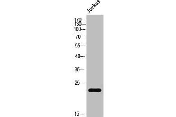 AKAP14 antibody  (N-Term)