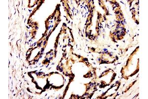 Paraformaldehyde-fixed, paraffin embedded rat kidney, Antigen retrieval by boiling in sodium citrate buffer (pH6. (C20ORF173 antibody  (AA 71-149))